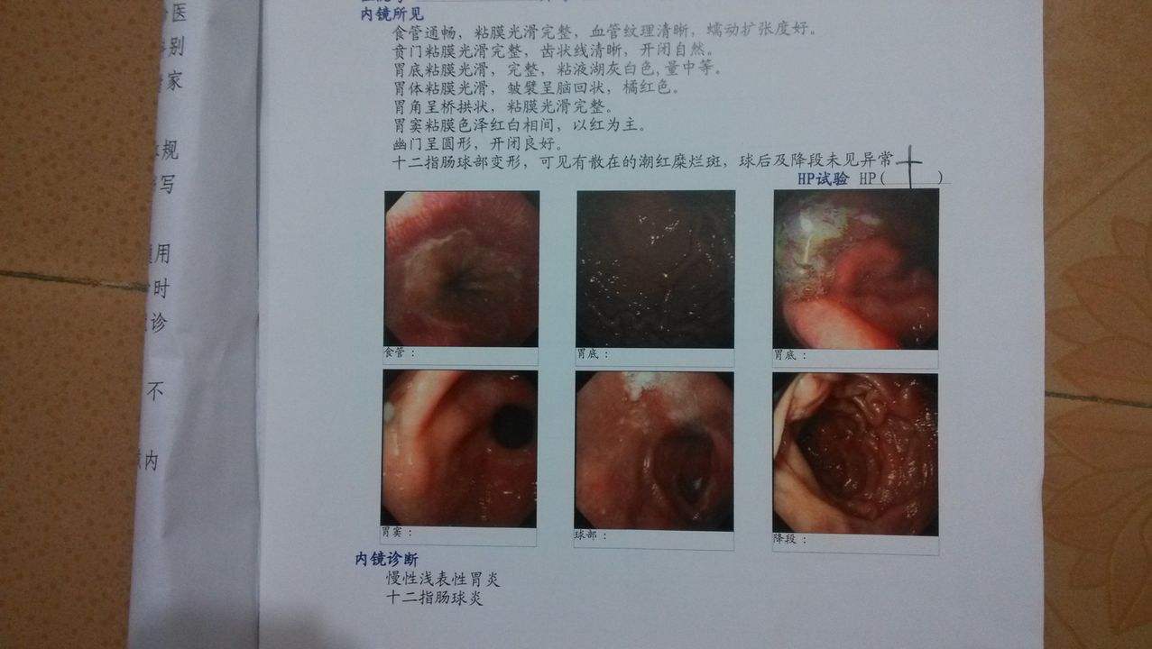 绿色动力产品服用效果分享